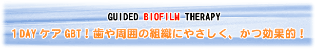 １DAYケアGBT  歯や周囲の組織にやさしく、かつ効果的！