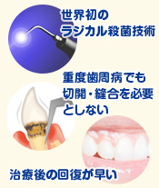 歯科用CT・パノラマレントゲン装置